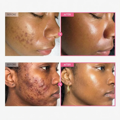 Kylie™Revive Cream