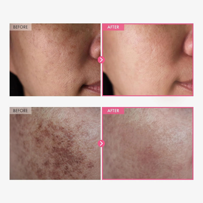 Kylie™Revive Cream